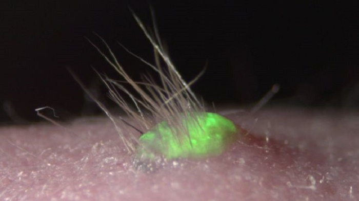 Promising lab-grown skin sprouts hair and grows glands